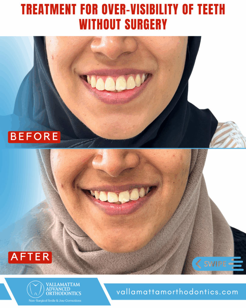 vao before after 16-04-2024 (1)