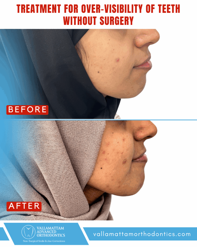 vao before after 16-04-2024 (2)