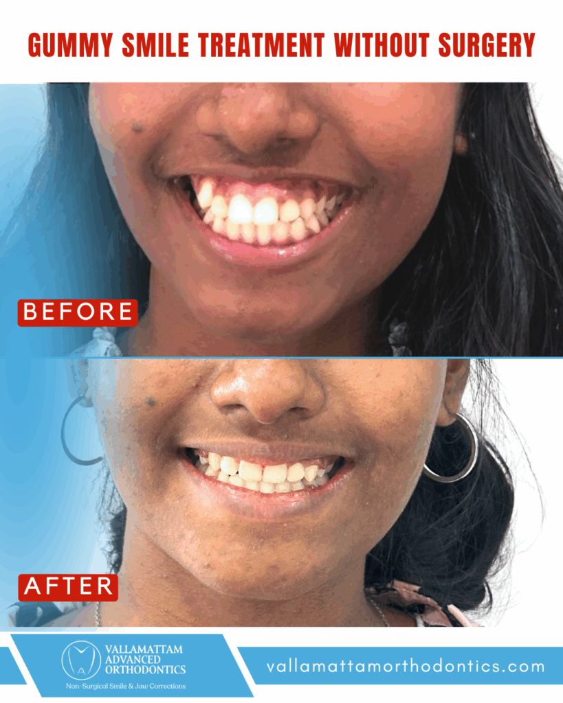 vao before after 16-04-2024 (4)