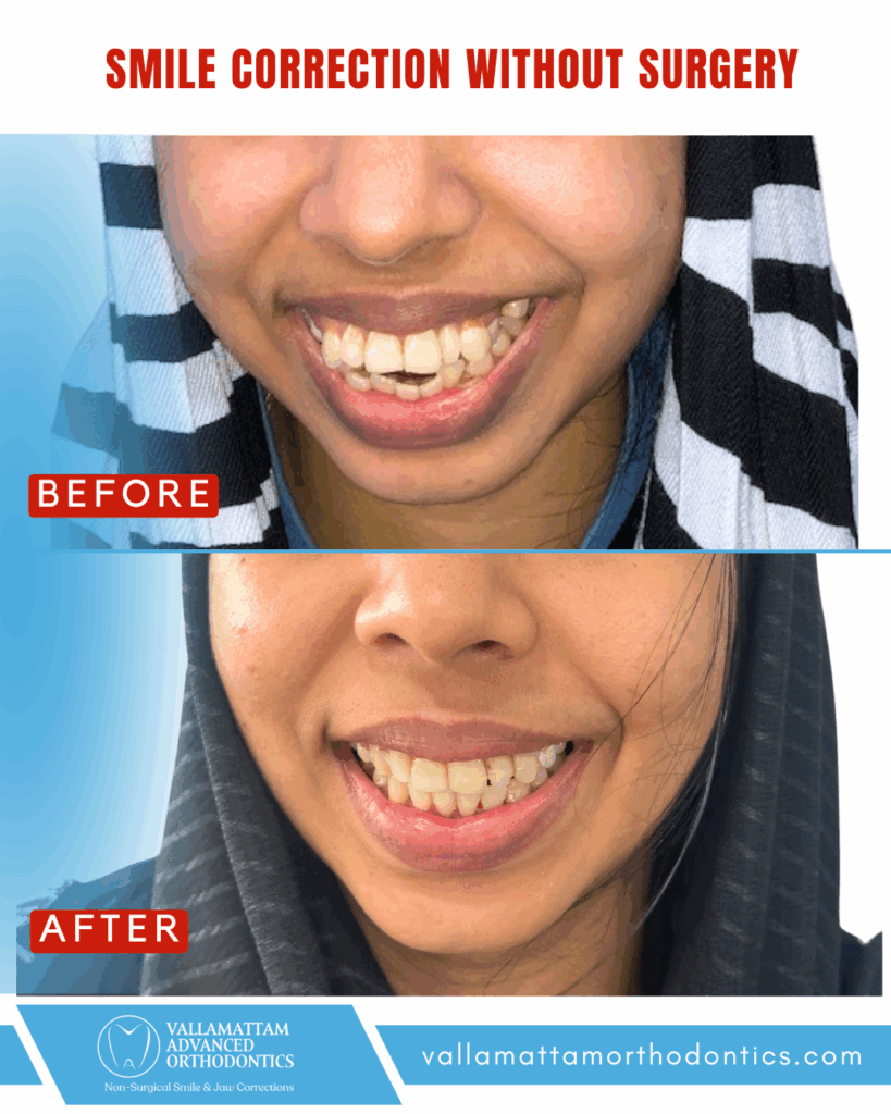 vao before after 16-04-2024 (5)