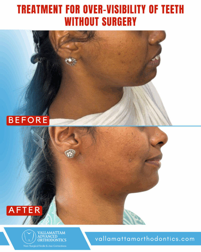 vao before after 16-04-2024 (8)