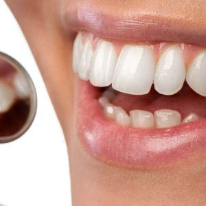 Understanding Over Visibility of Teeth: Causes and Consequences